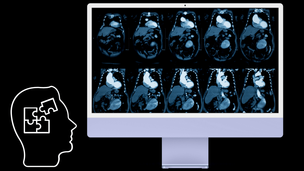 Diagnostic Radiologist Problem Solver - BrettMollard.com