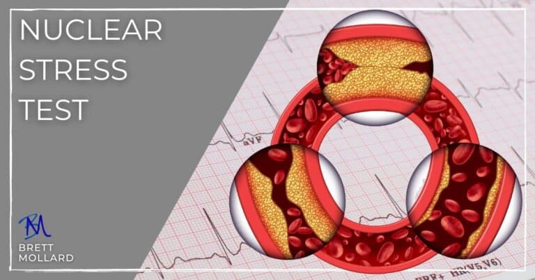 Nuclear Stress Test (Myocardial Perfusion Imaging) Demystified